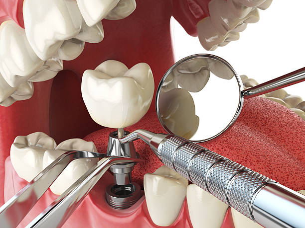 Best After-Hours Dental Trauma Care in Captains Cove, VA
